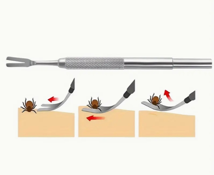 Tire-tiques en acier inoxydable