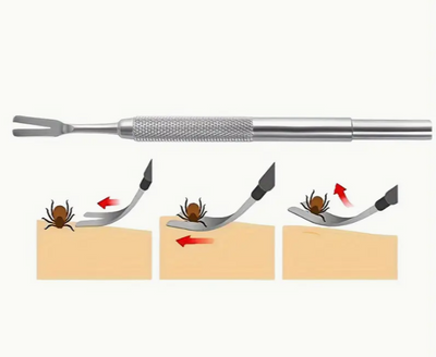 Tire-tiques en acier inoxydable